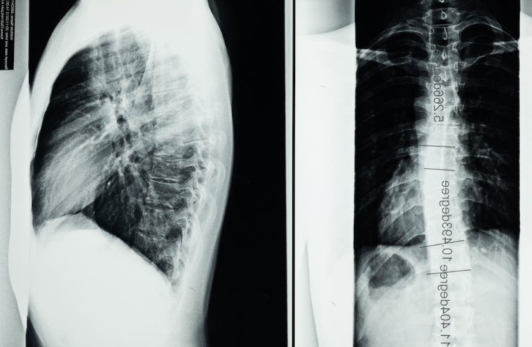 Czas oczekiwania na wynik rezonansu magnetycznego głowy – ile trwa diagnoza?