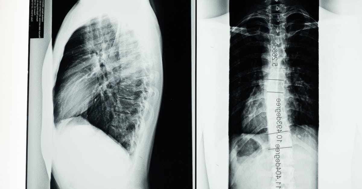 Czas oczekiwania na wynik rezonansu magnetycznego głowy - ile trwa diagnoza?